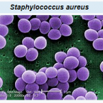 staphylococcus aureus